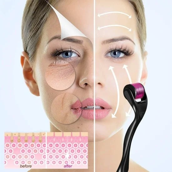 Derma Roller 0.5mm For Face Acne Scars Remover, 540 Titanium Alloy Needles For Anti-aging