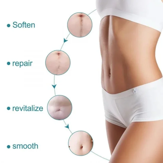Silicone scar tape | Scar Removal Sheet Strips for C-Section, Acne Scars, Tummy Tuck, Keloid and Surgical Scars | Reusable Medical Grade      Silicone Scar Tape | Get Scars Away Painless Reusable |   Silicone Scar Sheets | Silicone Scar Removal Sheet