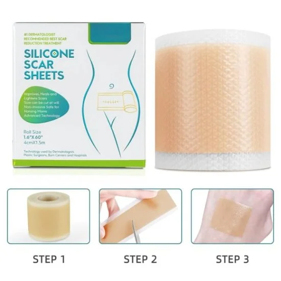 Silicone scar tape | Scar Removal Sheet Strips for C-Section, Acne Scars, Tummy Tuck, Keloid and Surgical Scars | Reusable Medical Grade      Silicone Scar Tape | Get Scars Away Painless Reusable |   Silicone Scar Sheets | Silicone Scar Removal Sheet